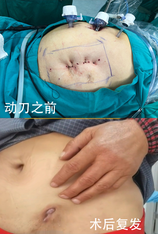 勿以疝小而不为