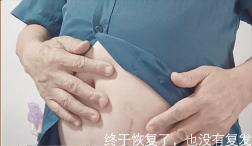 勿以疝小而不为